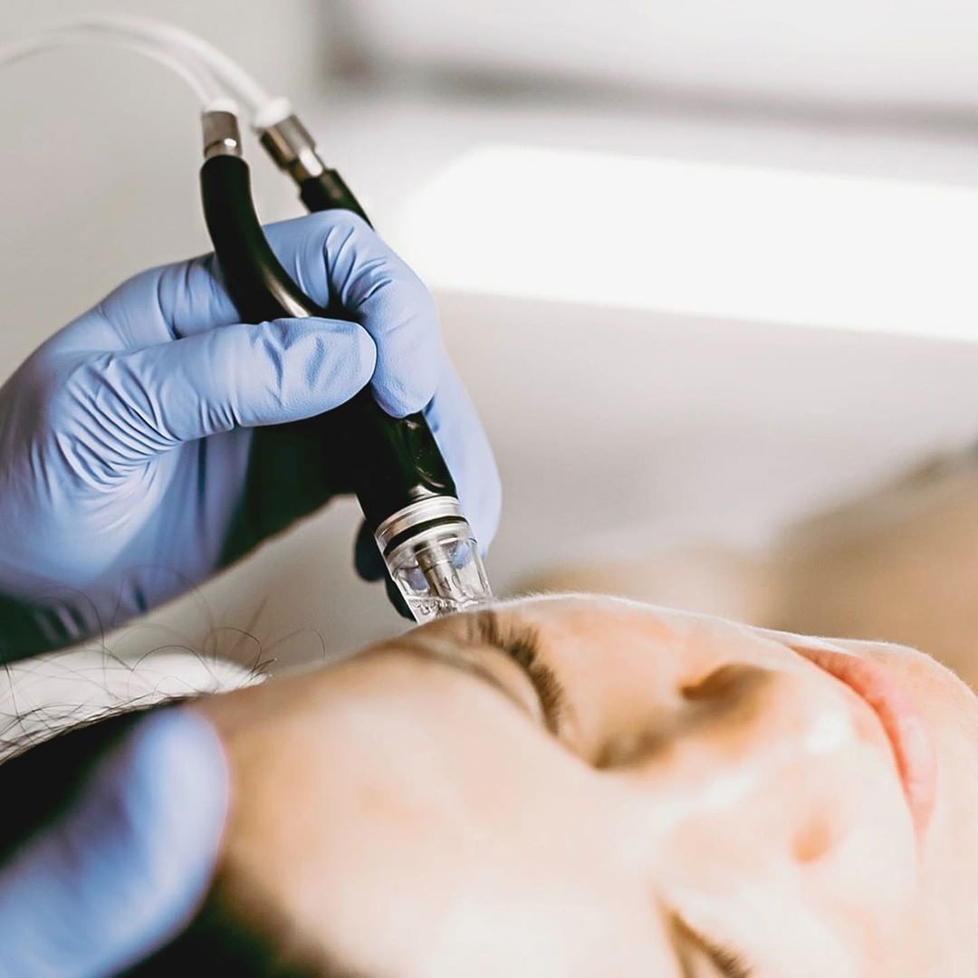 SilkPeel